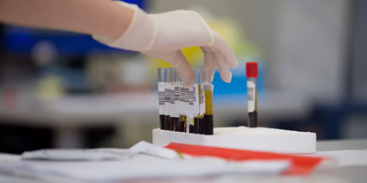 Mână cu mănușă medicală ținând o eprubetă cu sânge